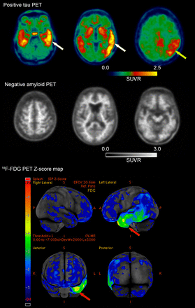 FIGURE 6.