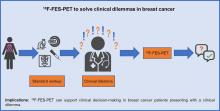 Value of <sup>18</sup>F-FES PET in Solving Clinical Dilemmas in Breast Cancer Patients: A Retrospective Study