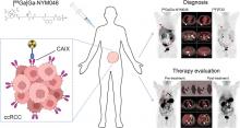 Value of [<sup>68</sup>Ga]Ga-NYM046 PET/CT, in Comparison with <sup>18</sup>F-FDG PET/CT, for Diagnosis of Clear Cell Renal Cell Carcinoma