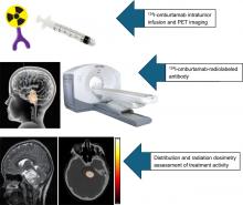 Theranostic Intratumoral Convection-Enhanced Delivery of <sup>124</sup>I-Omburtamab in Patients with Diffuse Intrinsic Pontine Glioma: Pharmacokinetics and Lesion Dosimetry