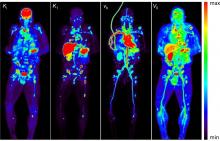 Total-Body PET Multiparametric Imaging of Cancer Using a Voxelwise Strategy of Compartmental Modeling