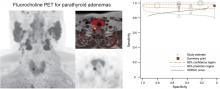 Assessment and Comparison of <sup>18</sup>F-Fluorocholine PET and <sup>99m</sup>Tc-Sestamibi Scans in Identifying Parathyroid Adenomas: A Metaanalysis