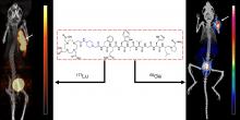 A Radiotracer for Molecular Imaging and Therapy of Gastrin-Releasing Peptide Receptor–Positive Prostate Cancer