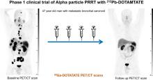 Targeted <strong>α</strong>-Emitter Therapy with <sup>212</sup>Pb-DOTAMTATE for the Treatment of Metastatic SSTR-Expressing Neuroendocrine Tumors: First-in-Humans Dose-Escalation Clinical Trial