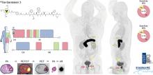 GRPr Antagonist <sup>68</sup>Ga-SB3 PET/CT Imaging of Primary Prostate Cancer in Therapy-Naïve Patients