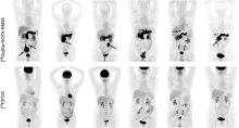 Head-to-Head Comparison of [<sup>68</sup>Ga]Ga-NOTA-RM26 and [<sup>18</sup>F]FDG PET/CT in Patients with Gastrointestinal Stromal Tumors: A Prospective Study