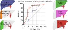 Voxel-Based Dosimetry Predicts Hepatotoxicity in Hepatocellular Carcinoma Patients Undergoing Radioembolization with <sup>90</sup>Y Glass Microspheres