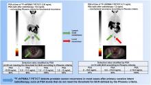 <sup>18</sup>F-rhPSMA-7 PET for the Detection of Biochemical Recurrence of Prostate Cancer After Curative-Intent Radiation Therapy: A Bicentric Retrospective Study