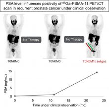 Clinical Factors That Influence Repeat <sup>68</sup>Ga-PSMA-11 PET/CT Scan Positivity in Patients with Recurrent Prostate Cancer Under Observation After a Negative <sup>68</sup>Ga-PSMA-11 PET/CT Scan: A Single-Center Retrospective Study