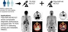 Head-to-Head Comparison of <sup>68</sup>Ga-FAPI-46 and <sup>18</sup>F-FDG PET/CT for Evaluation of Head and Neck Squamous Cell Carcinoma: A Single-Center Exploratory Study