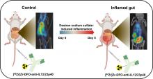 Detection of IL12/23p40 via PET Visualizes Inflammatory Bowel Disease