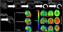 Investigating Tau and Amyloid Tracer Skull Binding in Studies of Alzheimer Disease