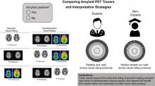 Toward a Universal Readout for <sup>18</sup>F-Labeled Amyloid Tracers: The CAPTAINs Study