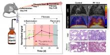 Radiolabeled GPVI-Fc for PET Imaging of Multiple Extracellular Matrix Fibers: A New Look into Pulmonary Fibrosis Progression