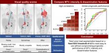 The Impact of Semiautomatic Segmentation Methods on Metabolic Tumor Volume, Intensity, and Dissemination Radiomics in <sup>18</sup>F-FDG PET Scans of Patients with Classical Hodgkin Lymphoma