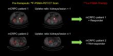 Prediction of Response to <sup>177</sup>Lu-PSMA Therapy Based on Tumor-to-Kidney Ratio on Pretherapeutic PSMA PET/CT and Posttherapeutic Tumor-Dose Evaluation in mCRPC