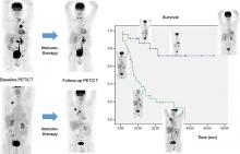 Response Evaluation and Survival Prediction After PD-1 Immunotherapy in Patients with Non–Small Cell Lung Cancer: Comparison of Assessment Methods