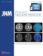 Journal of Nuclear Medicine: 55 (4)