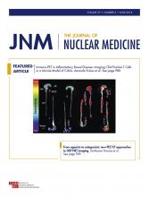 Journal of Nuclear Medicine: 59 (6)