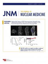 Journal of Nuclear Medicine: 59 (7)